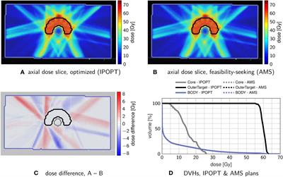 Superiorization of projection algorithms for linearly constrained inverse radiotherapy treatment planning